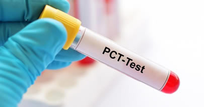 pct test